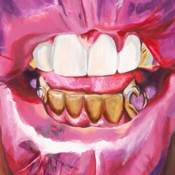 Grillz 4 (on Canvas)